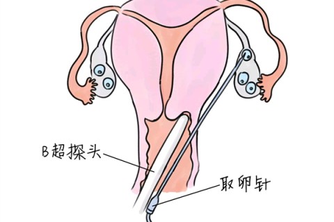 http://shijiazhuang.vdtfzz.com/post/205.html|石家庄供卵助孕