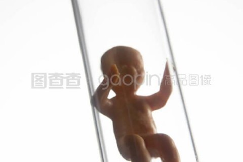 http://shijiazhuang.vdtfzz.com/post/197.html|石家庄试管助孕